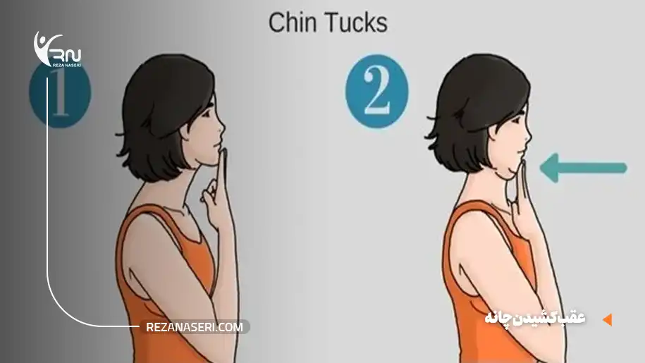 عقب کشیدن چانه (Chin Tuck)